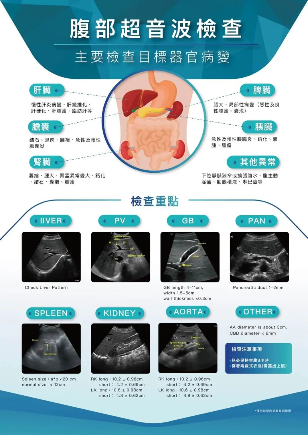 超音波檢測