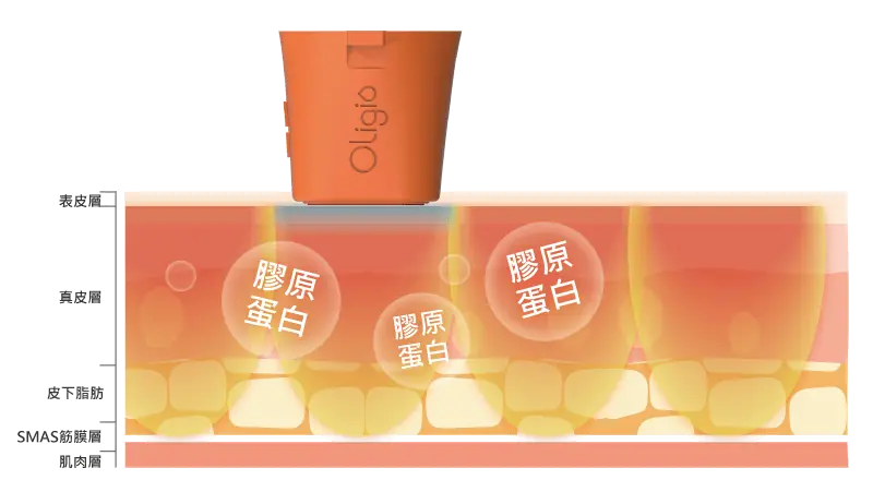 Oligio電波