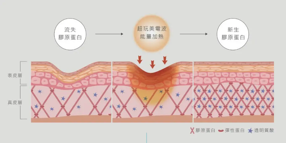Oligio X超玩美電波