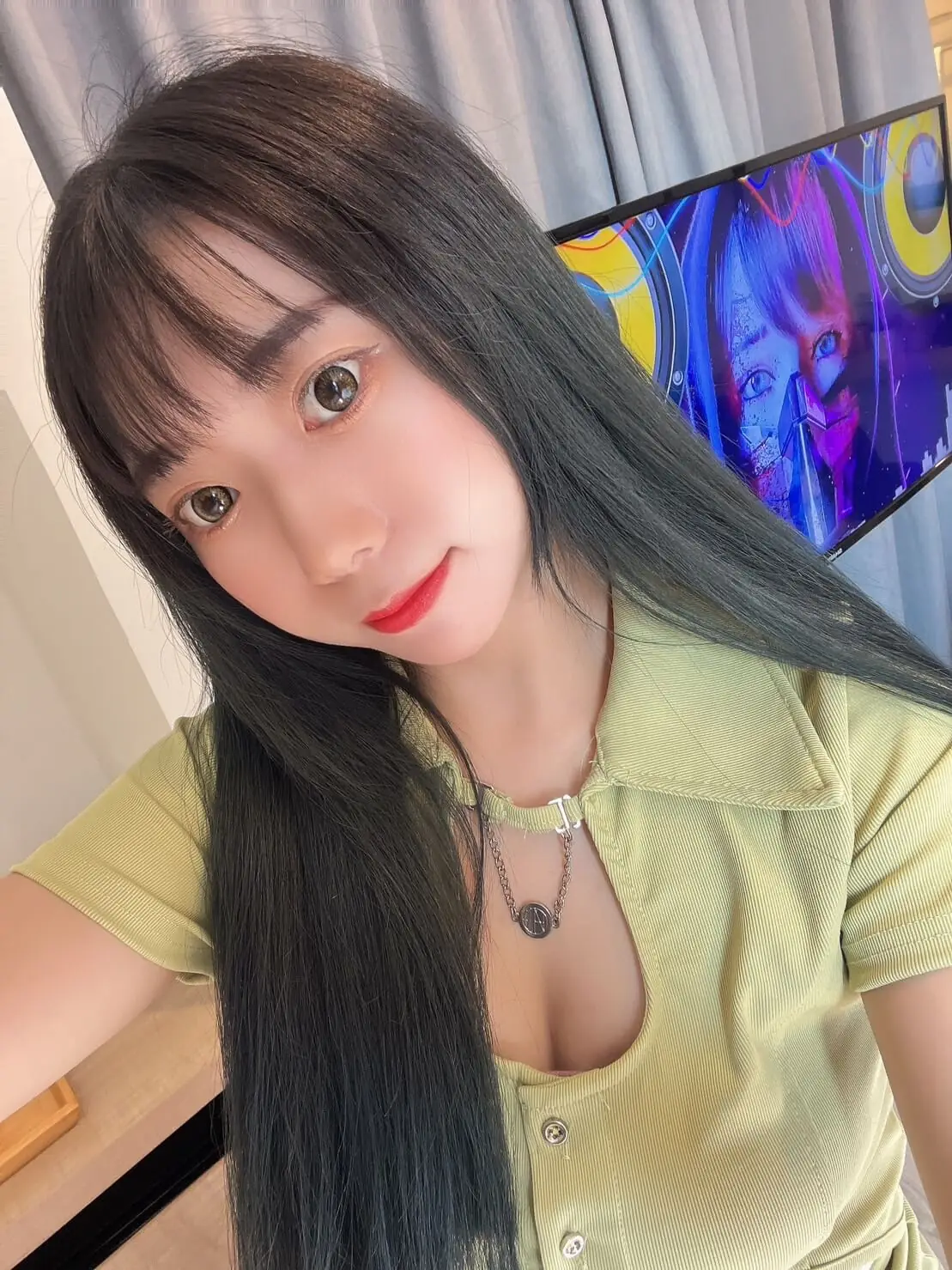 玻尿酸注射