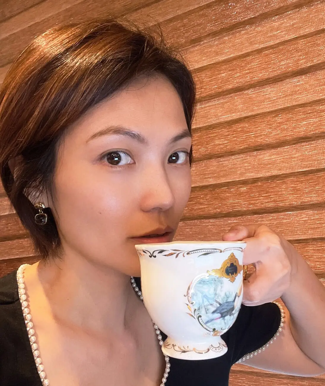 玻尿酸注射