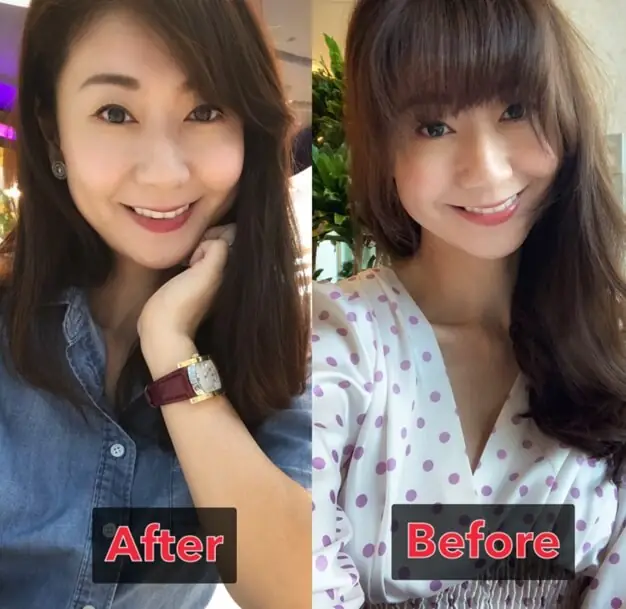 Eileen:英爵醫美讓我的年齡繼續是秘密