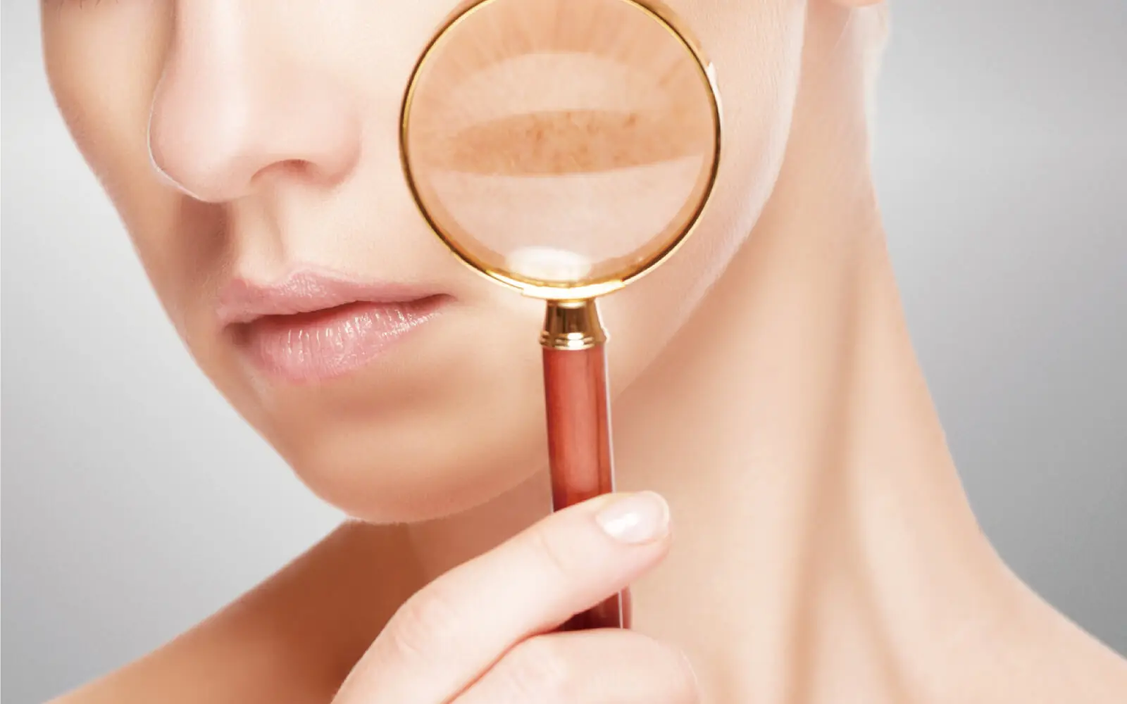 除斑雷射MedLite