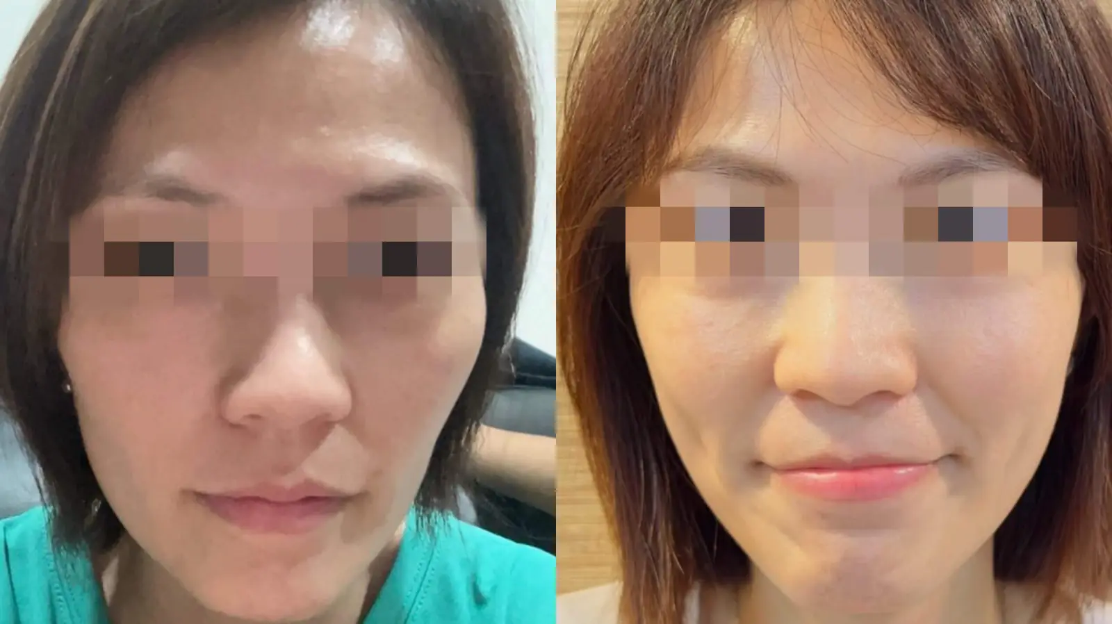 想要實現自然有效的悄悄變美, 需要一個客製化的全方位複合療程