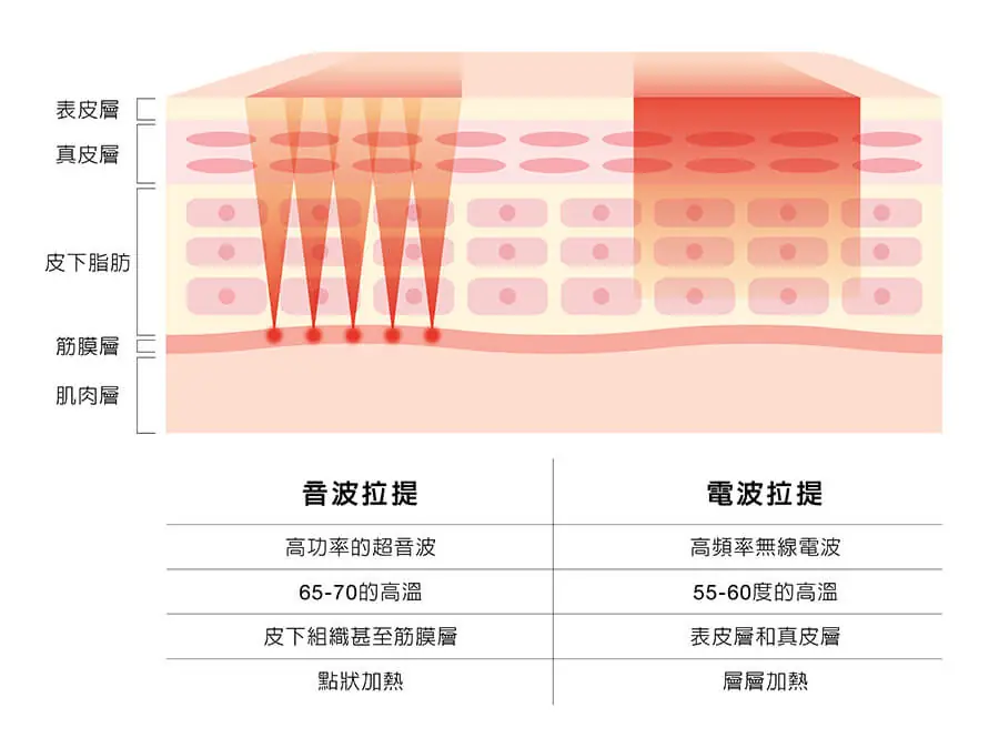 電音&音波得比較圖