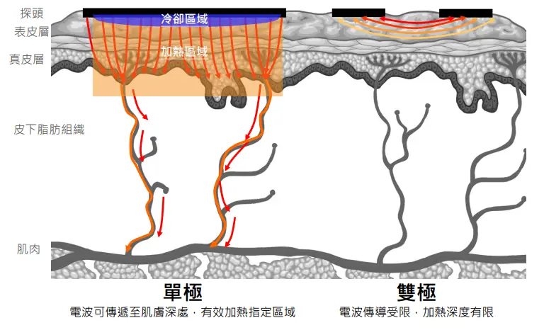 Oligio電波訂製你的專屬美