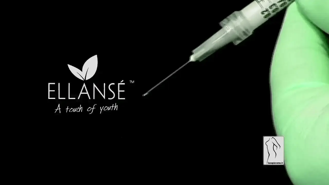打造澎潤美顏的新選擇-洢蓮絲 (Ellanse)