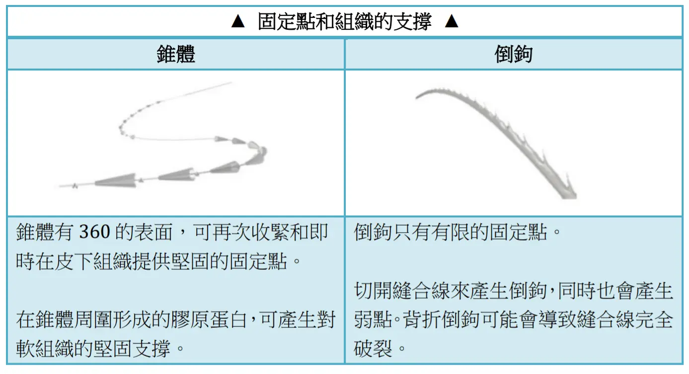 埋線的線材有哪些秘密?