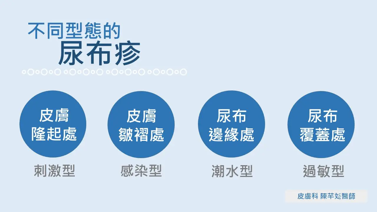 你家寶寶也有紅屁屁嗎?嬰兒最常見的皮膚問題之—尿布疹