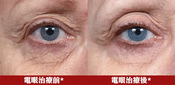 下垂瞇瞇眼