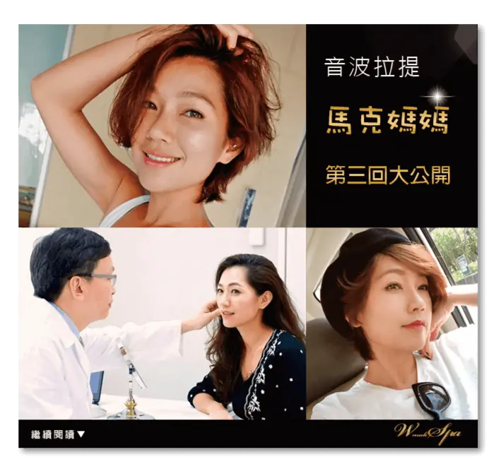 Ulthera極線音波拉提
