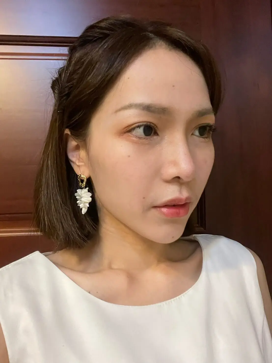絲絲 : 法令紋+夫妻宮凹陷，打造自然澎潤好氣色，擺脫疲累感!｜玻尿酸