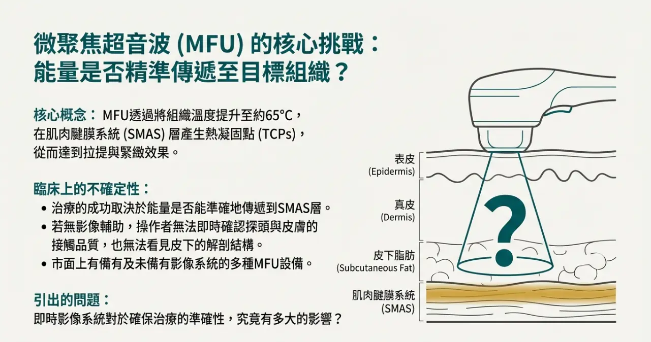 Ultherapy超音波拉提治療成功的重要關鍵 – 即時影像