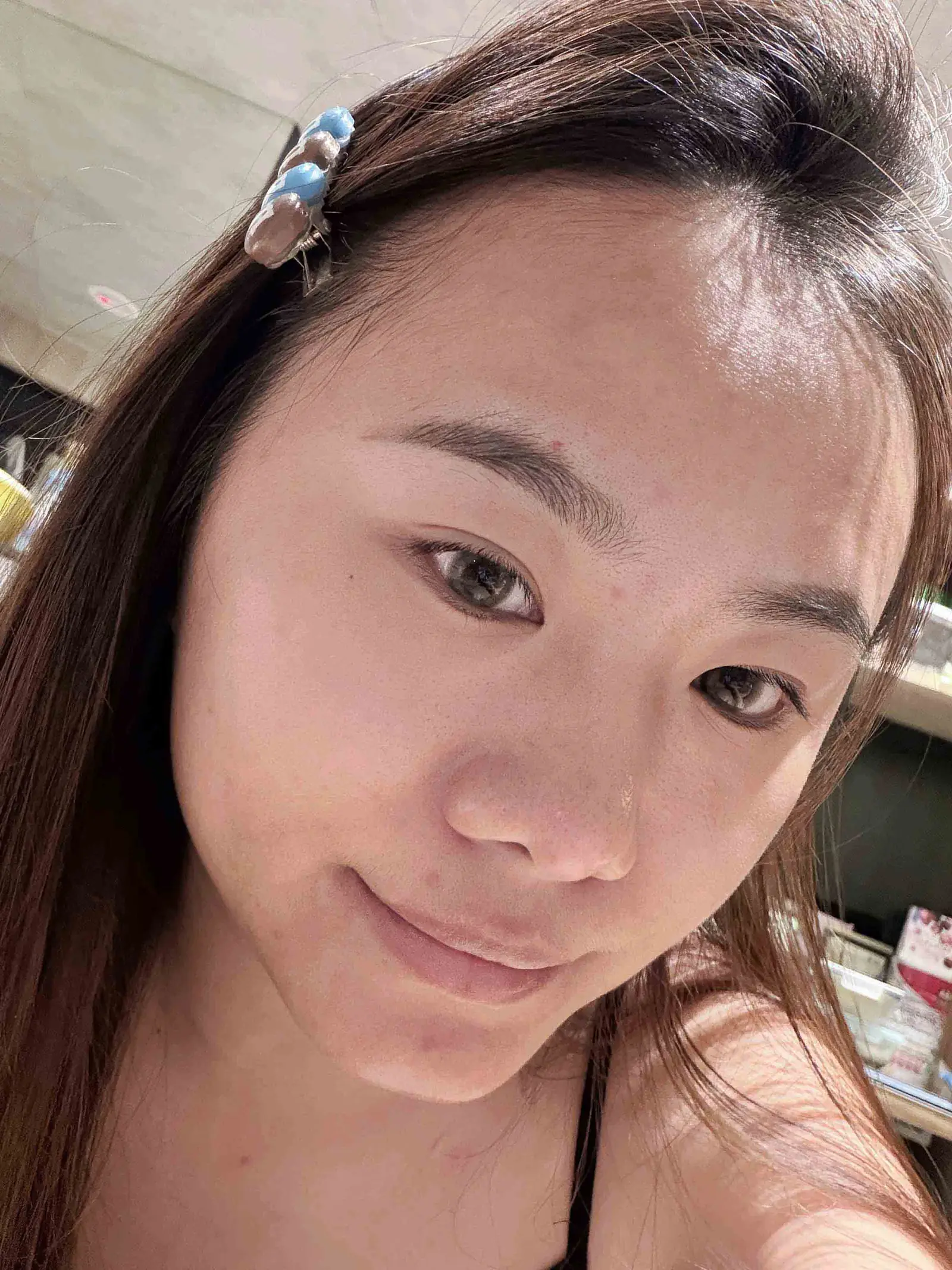 Julie : 從暗沉痘疤到無暇好膚質，找回肌膚自信光彩｜心動光